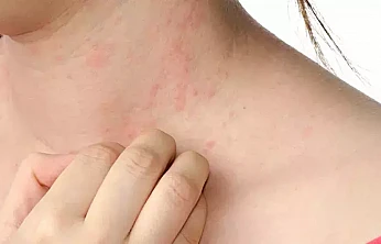 Yumurta alerjisi olanlar dikkat! Grip aşısı öncesi doktora danışın