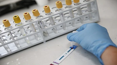 İzmir'de kimliksiz ve ücretsiz HIV testi dönemi başladı