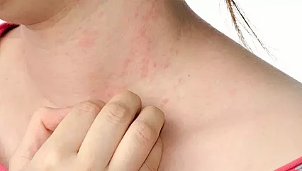 Yumurta alerjisi olanlar dikkat! Grip aşısı öncesi doktora danışın