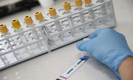 İzmir'de kimliksiz ve ücretsiz HIV testi dönemi başladı