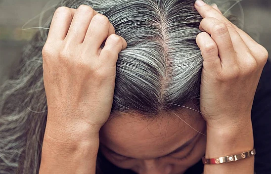 Beyaz Saçlar Geri Nasıl Siyahlaşır?