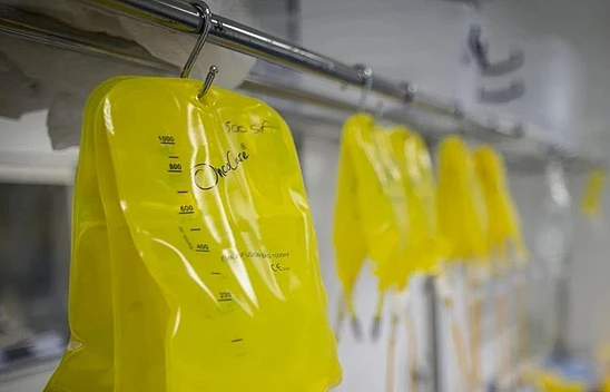 Sarı serum nedir ve neden tehlikeli?