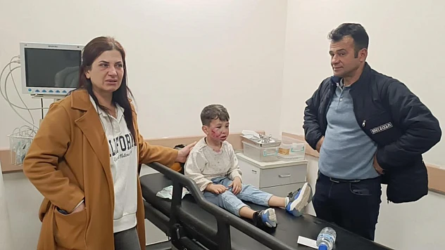 7 yaşındaki çocuğa köpek saldırısı!