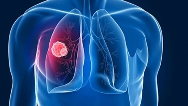 DSÖ Uyardı: Tüberküloz her yıl 1,2 milyondan fazla insanın hayatına mal oluyor