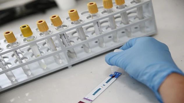 İzmir'de kimliksiz ve ücretsiz HIV testi dönemi başladı
