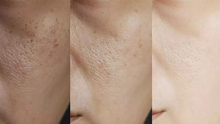 Herkesin konuştuğu cildi beyazlatan o maske! Yapması da oldukça kolay