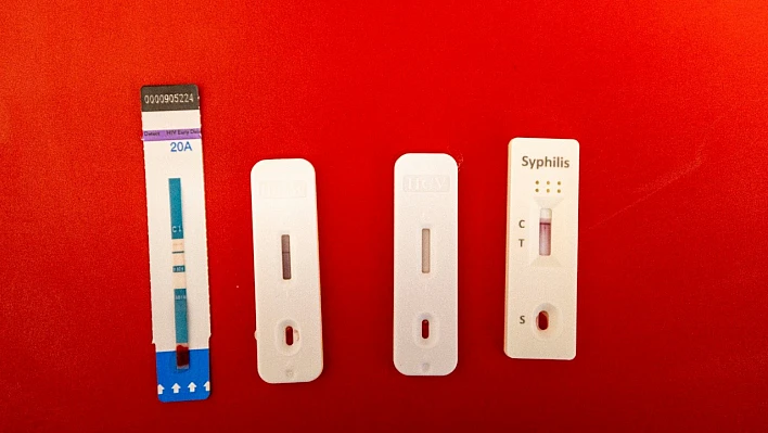 İzmir'de cinsel yolla bulaşan hastalıklar için kimliksiz ve ücretsiz test dönemi başladı