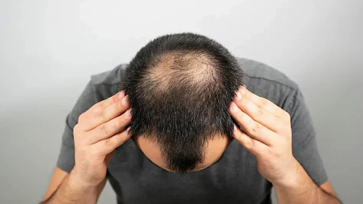 Saç Sağlığının Anahtarı: Doğru Beslenme