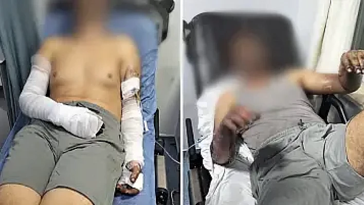 Sanayi sitesinde patlama: 2 işçi yaralandı