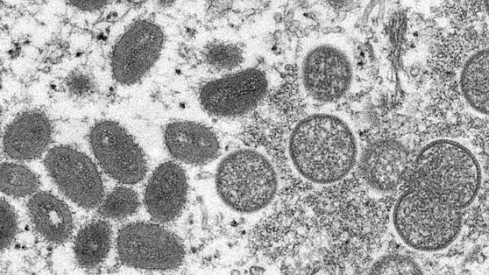 Türk ve İngiliz bilim insanlarından Mpox aşısı için işbirliği
