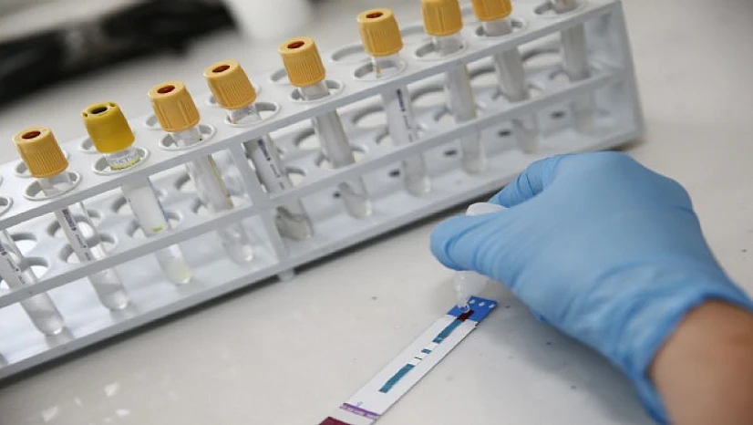 İzmir'de kimliksiz ve ücretsiz HIV testi dönemi başladı
