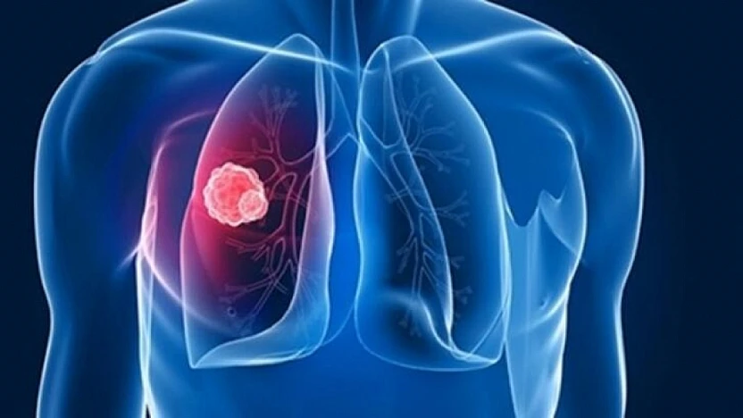 DSÖ Uyardı: Tüberküloz her yıl 1,2 milyondan fazla insanın hayatına mal oluyor